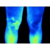 fluke_ti400_humanthermografie_beine_1420562362